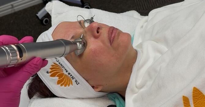 Laser Hair Removal